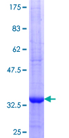 12.5% SDS-PAGE Stained with Coomassie Blue.
